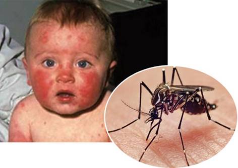 Muỗi là nguyên nhân chính dẫn đến các bệnh truyền nhiễm do virut